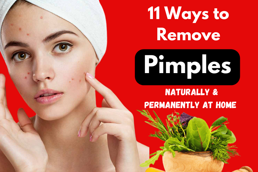 Remove Pimples Naturally and Permanently at Home