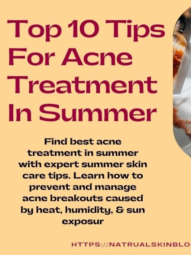 Acne Treatment In Summer